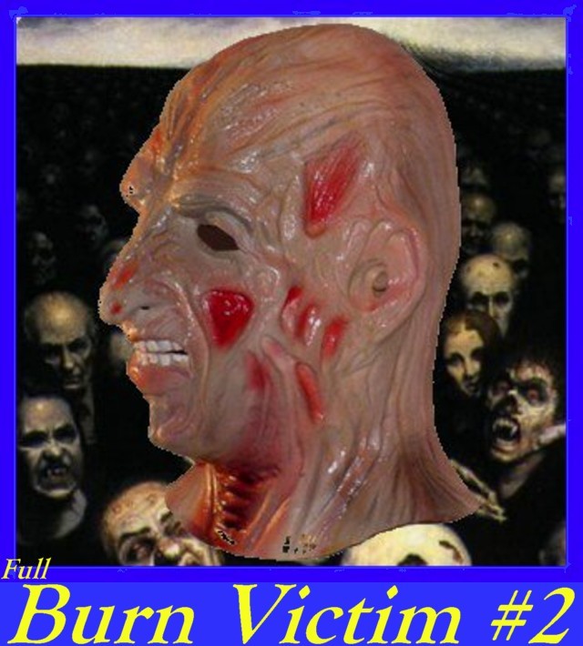 Burn Victim #1 mask